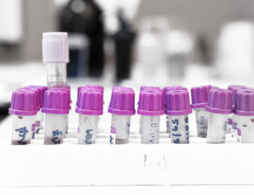 Auto-Immune blood diseases